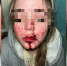 Толпа подростков избила 17-летнюю девушку в торговом центре — пострадавшую госпитализировали с тяжелыми травмами - Readovka67.Ru